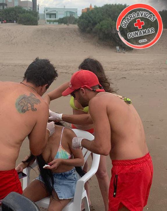 Le pegó una sombrilla en la cabeza. Fue asistida por Guardavidas en Dunamar